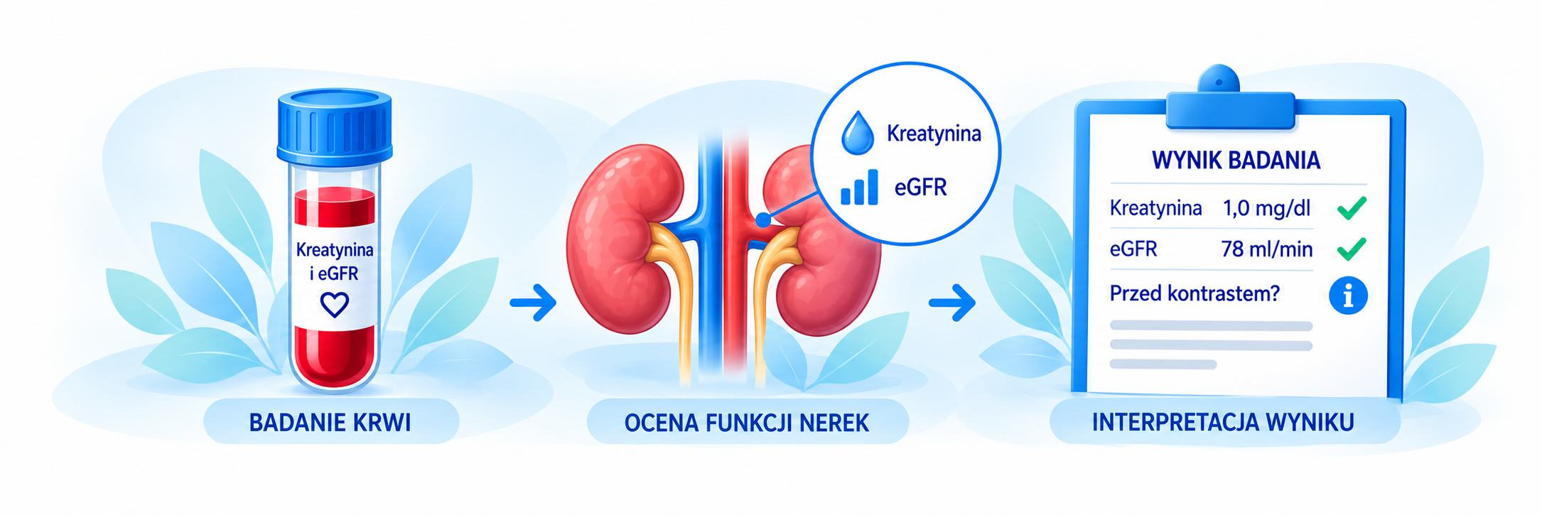 Kreatynina i eGFR